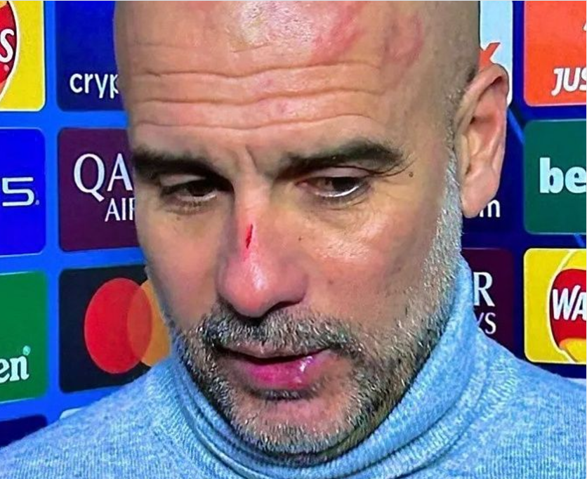 Guardiola coça o rosto em frustração após empate com o Feyenoord