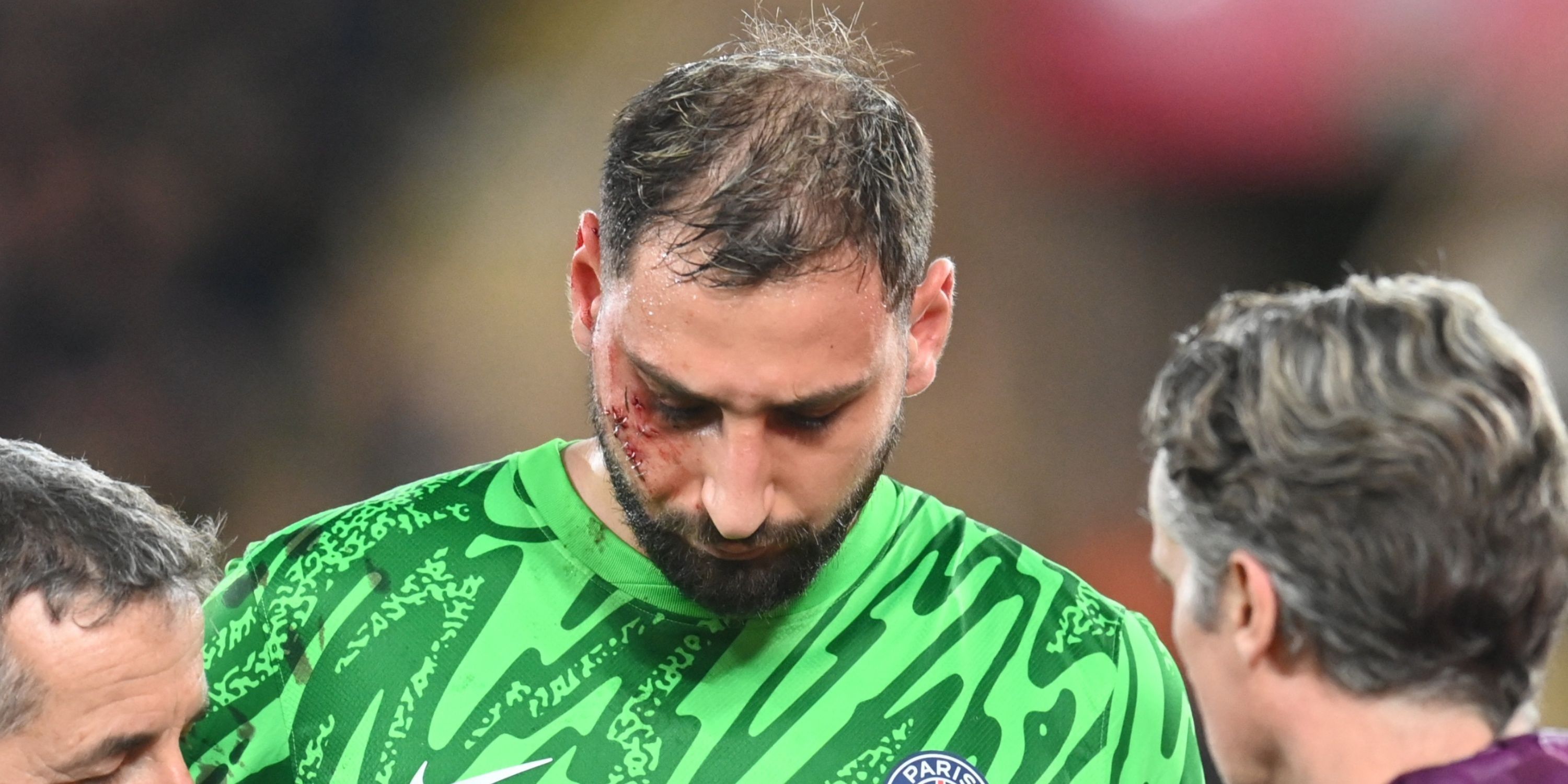 Donnarumma Shares First Photo After Facial Injury